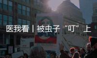 医我看丨被虫子“叮”上 
，发现“高烧和焦痂”？别大意	，这样急救！